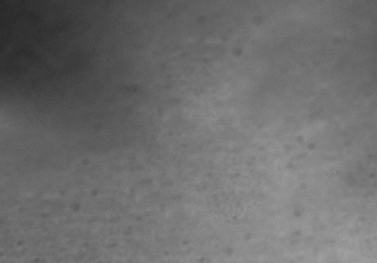 bd035_mo_top_a_2